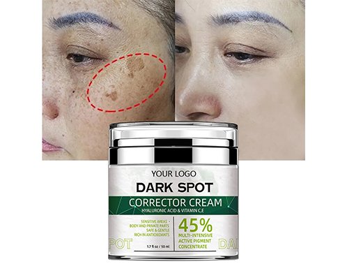 dark spot cream