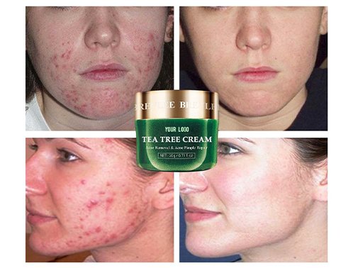 oem tea tree face cream
