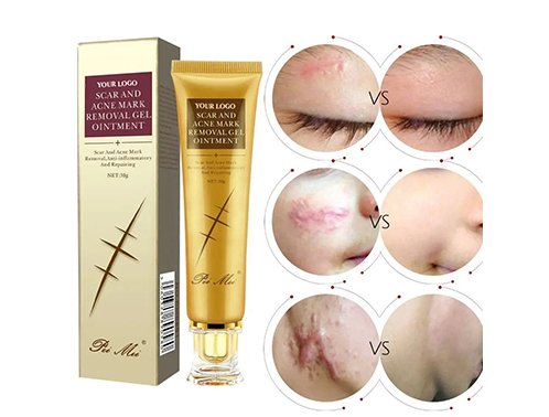 scar and acne removal cream