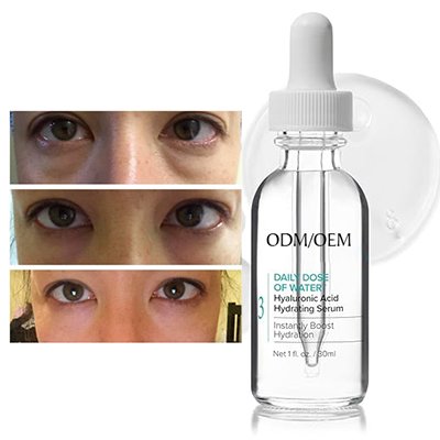 hyaluronic acid eye serum