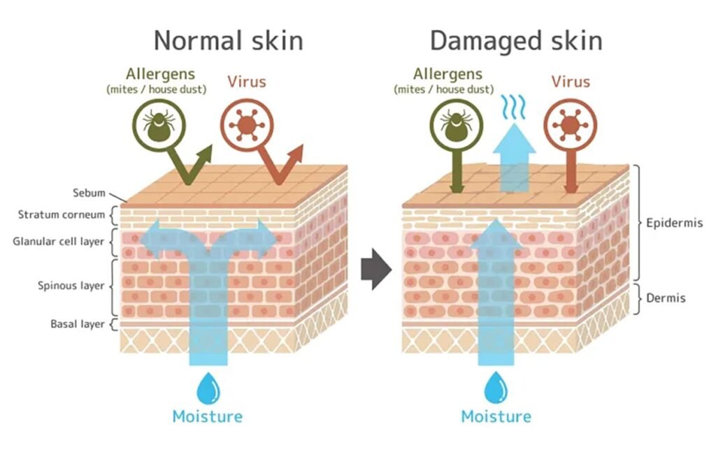 How do you know your skin barrier is damaged?